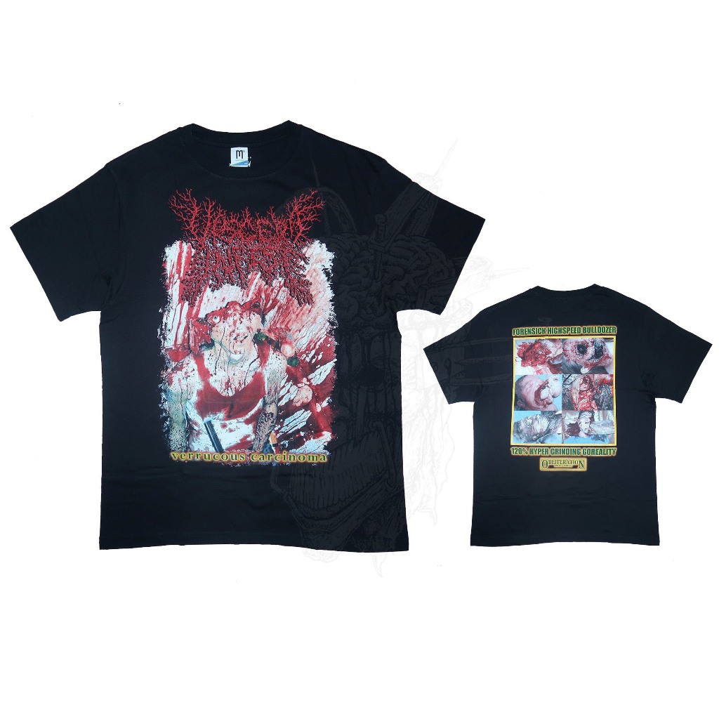 T-Shirt - Viscera Infest - Verrucous Carcinoma