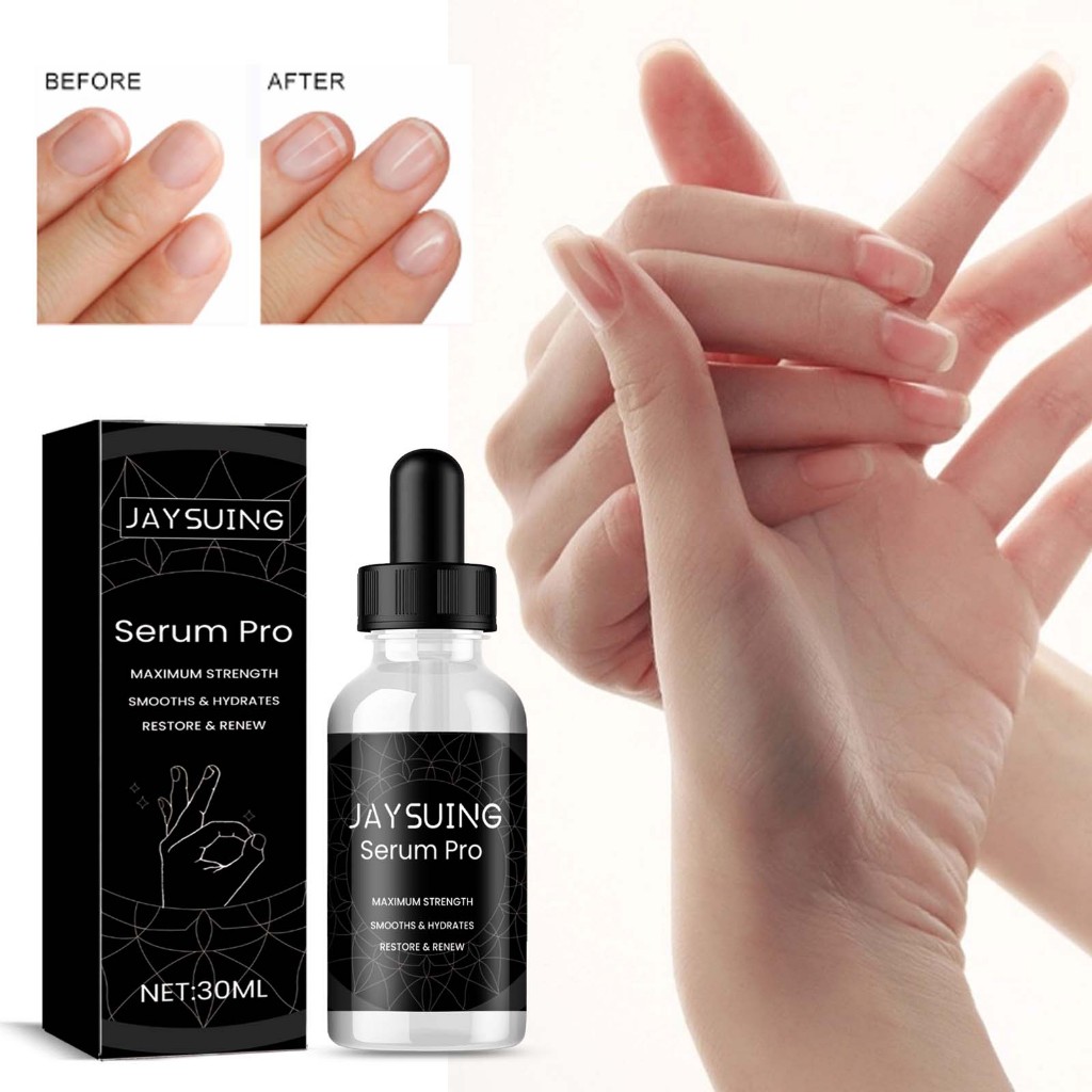 Jaysuing Nail Repair Essence 30ml Obat Cantengan Kuku Kaki Esensi Perbaikan Kuku Jamur Dan Rusak Tan
