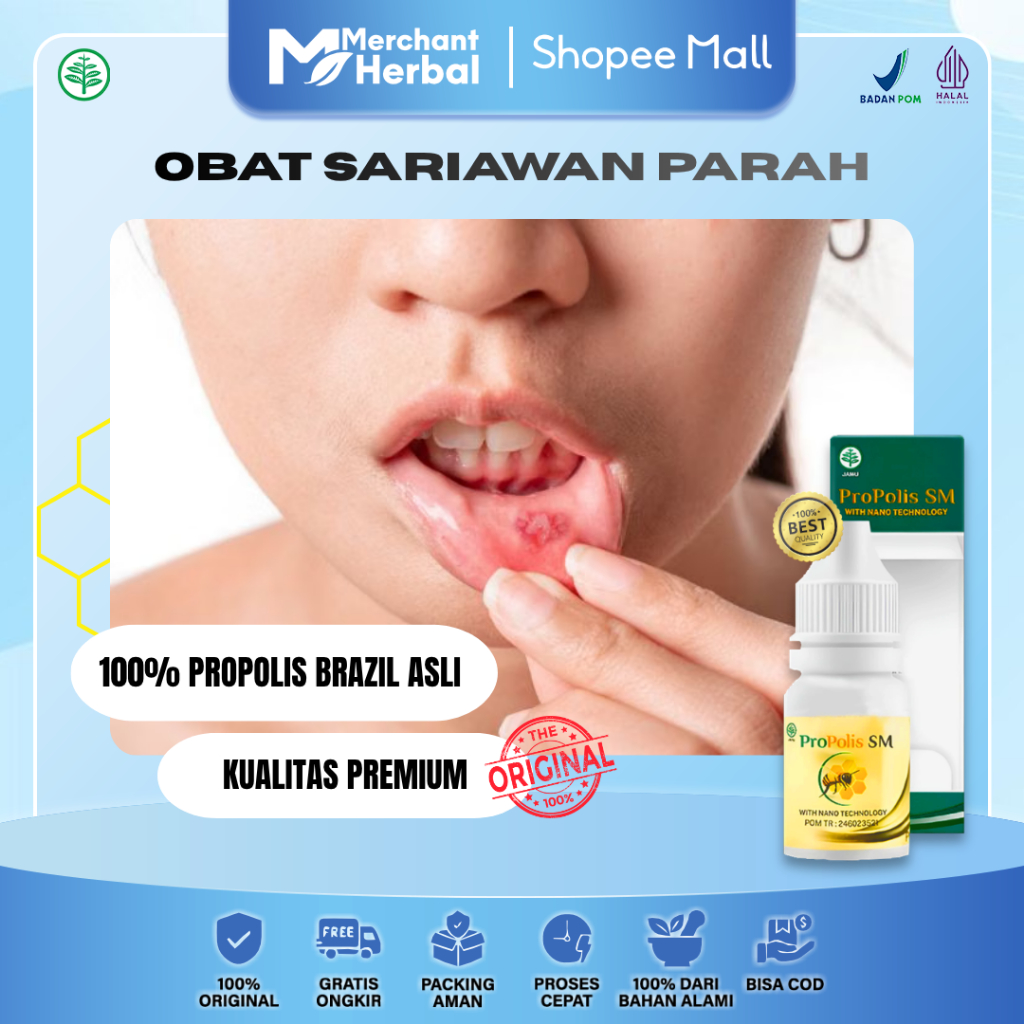 Sariawan Parah & Jamur Mulut – Propolis SM