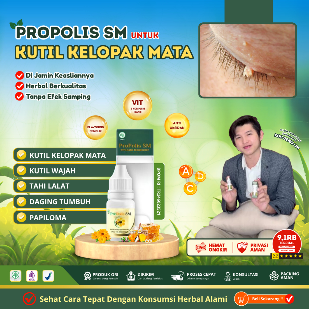 Obat Kutil di Kelopak Mata - Obat Penghilang Kutil di Kelopak Mata dan Wajah - Perontok Papiloma