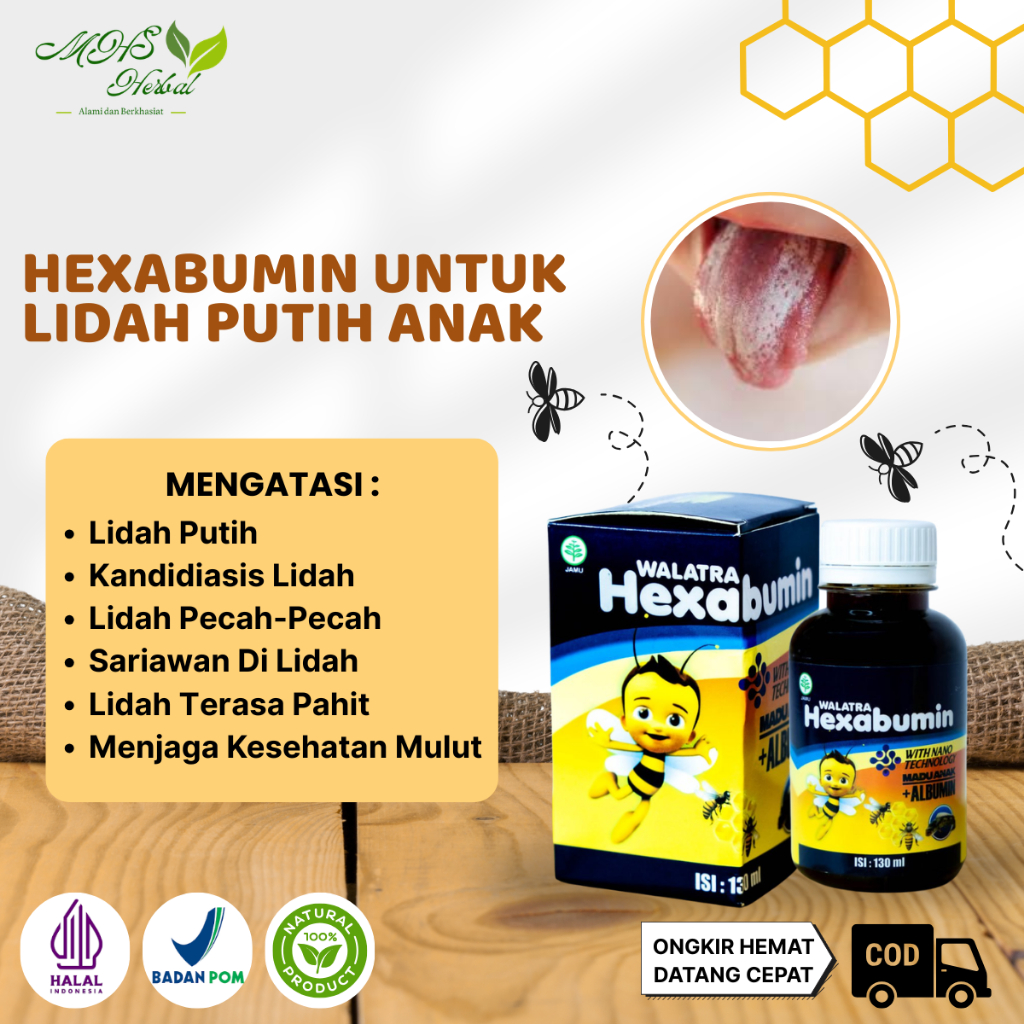 Obat Lidah Putih Pada Anak, Lidah Terasa Pahit, Lidah Pecah-Pecah, Kandidiasis Lidah, Sariawan Di Li