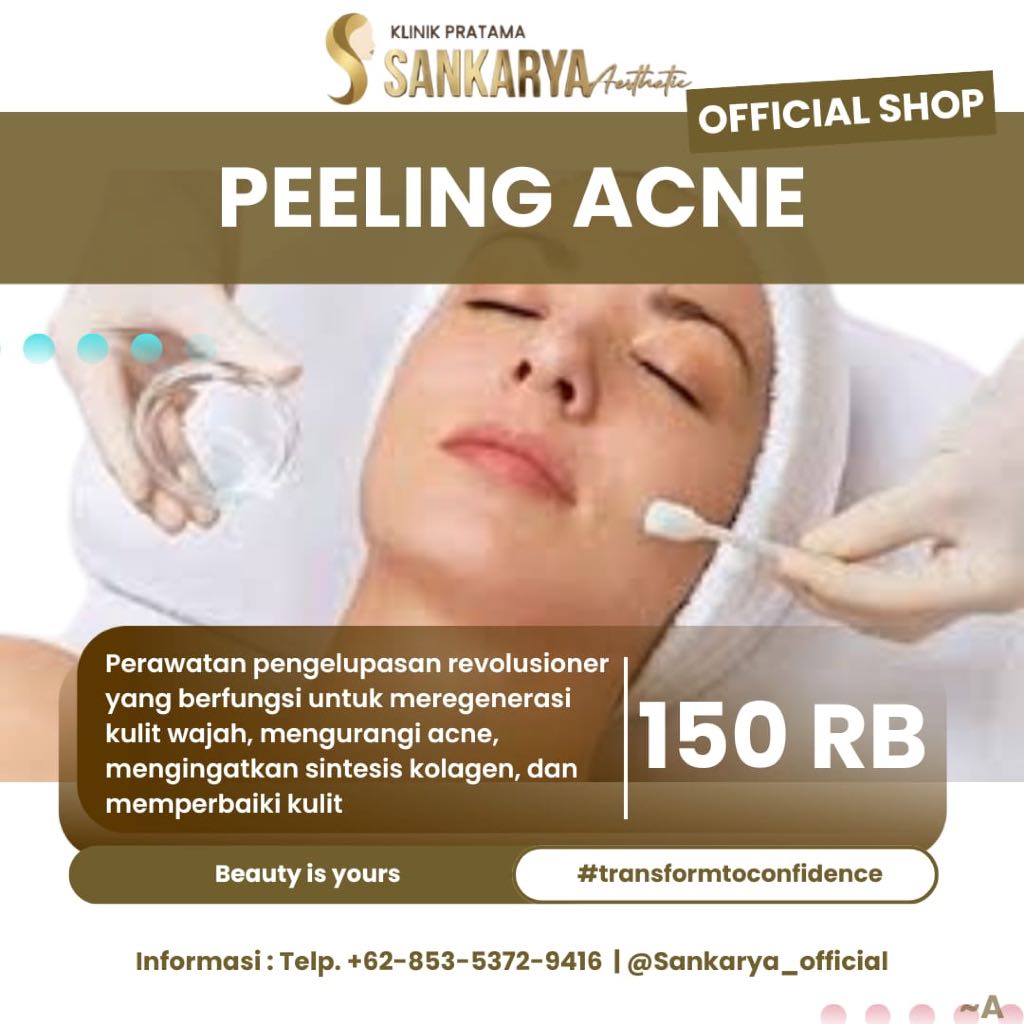 SANKARYA AESTHETIC Peeling Acne