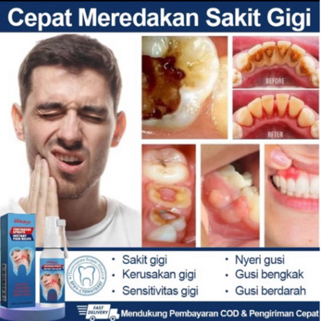 ORIGINAL Obat Sakit Gigi Semprot Obat Gusi Bengkak Obat Sakit Gigi Dan Gusi Toothache Spray Ubat Sak