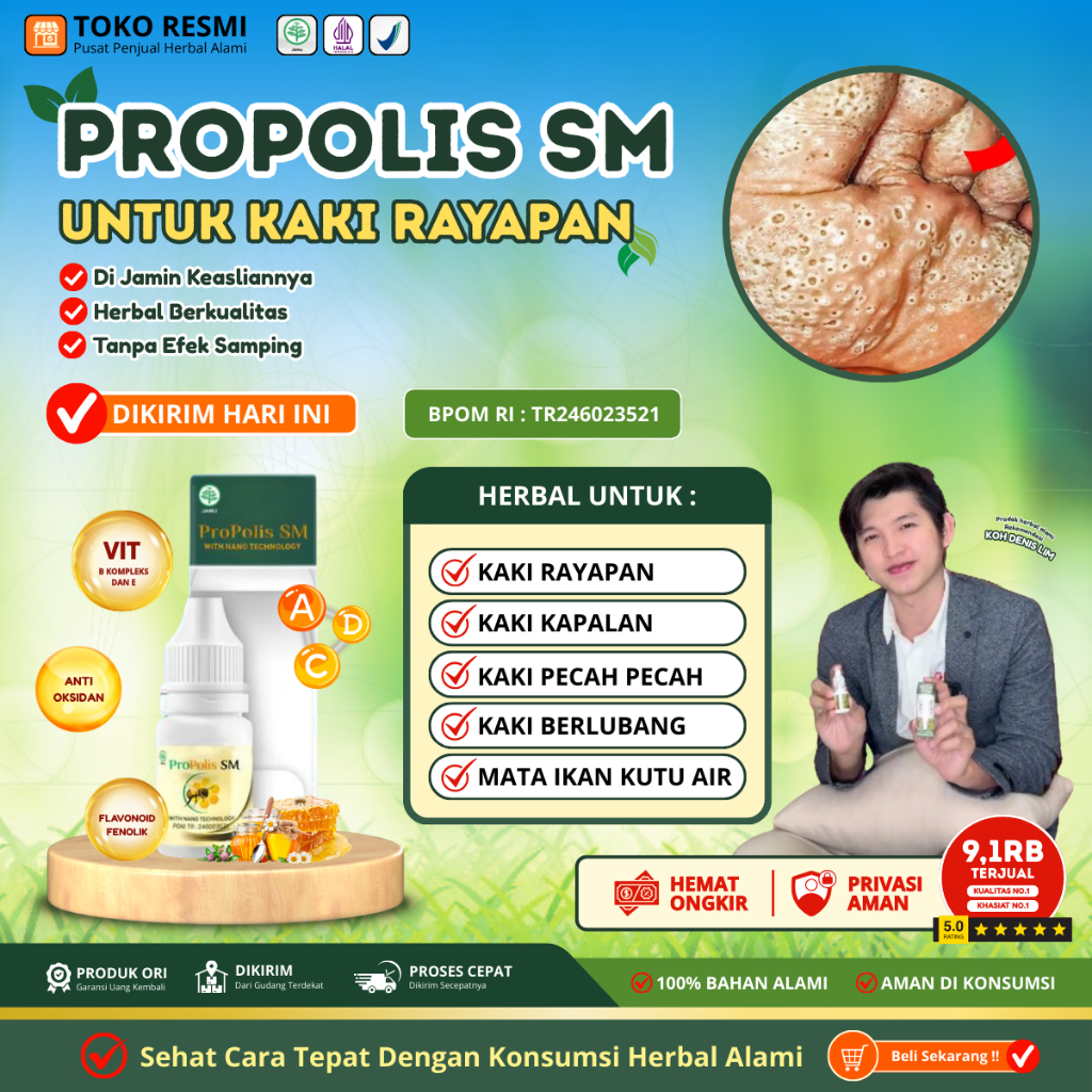 Obat Kaki Rayapan Telapak Kaki Bolong-Bolong Telapak Kaki Bolong Bolong Kecil, Kaki Pecah Dan Kering