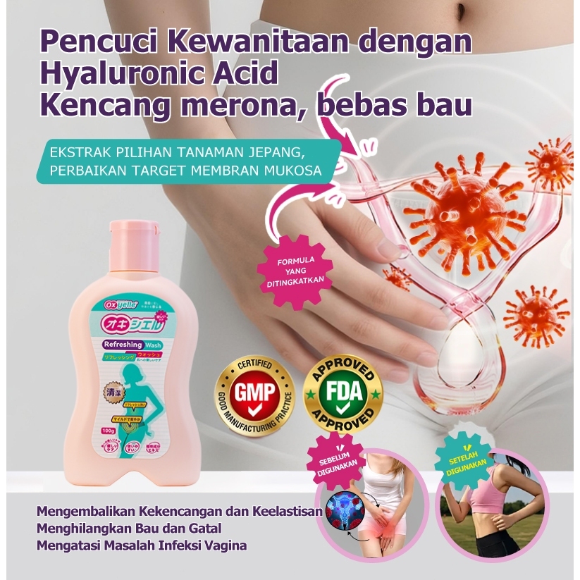 Oxyelle Cairan Perawatan Kewanitaan Lembut Membersihkan Menyegarkan dan Mengurangi Gatal