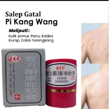 salep gatal/salep pkw original