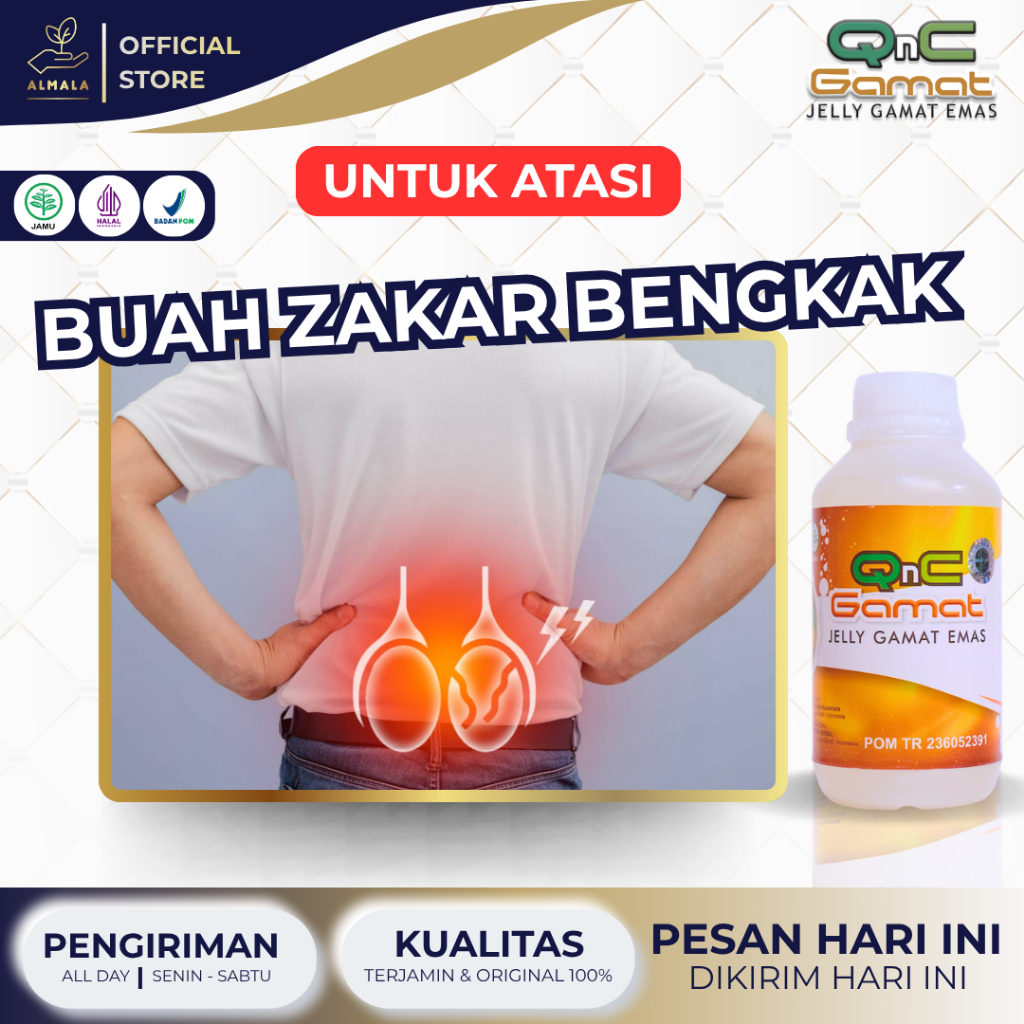Obat Buah Zakar Bengkak, Sakit Buah Zakar, Varikokel Testis, Biji Pelir Sakit Sebelah, Buah Zakar Ke