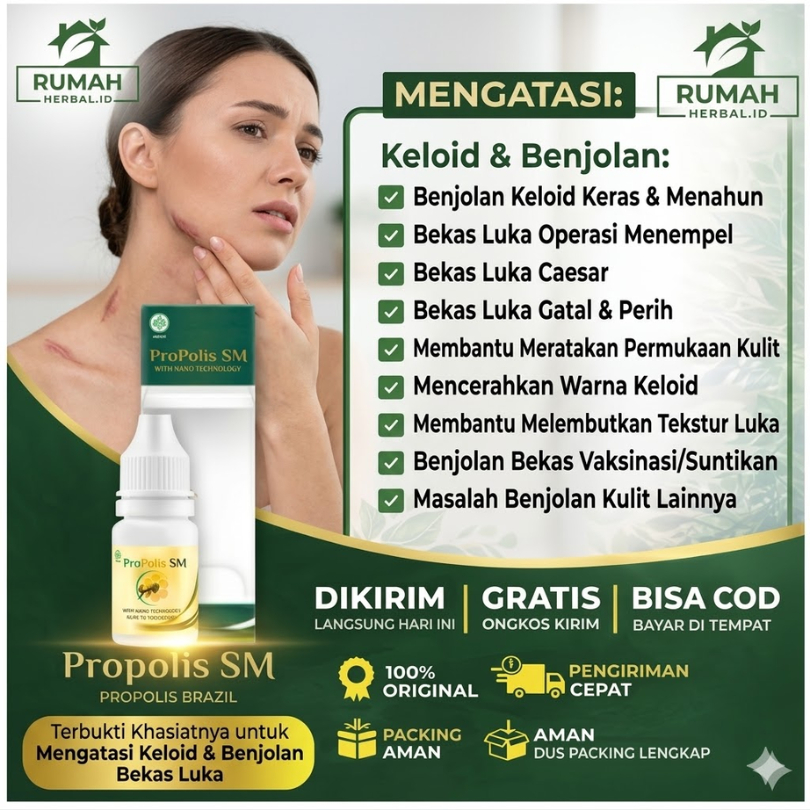 Propolis SM Brazilian Nano Technology Untuk Mengatasi Keloid Dan Bekas Luka Menahun Bekas Operasi