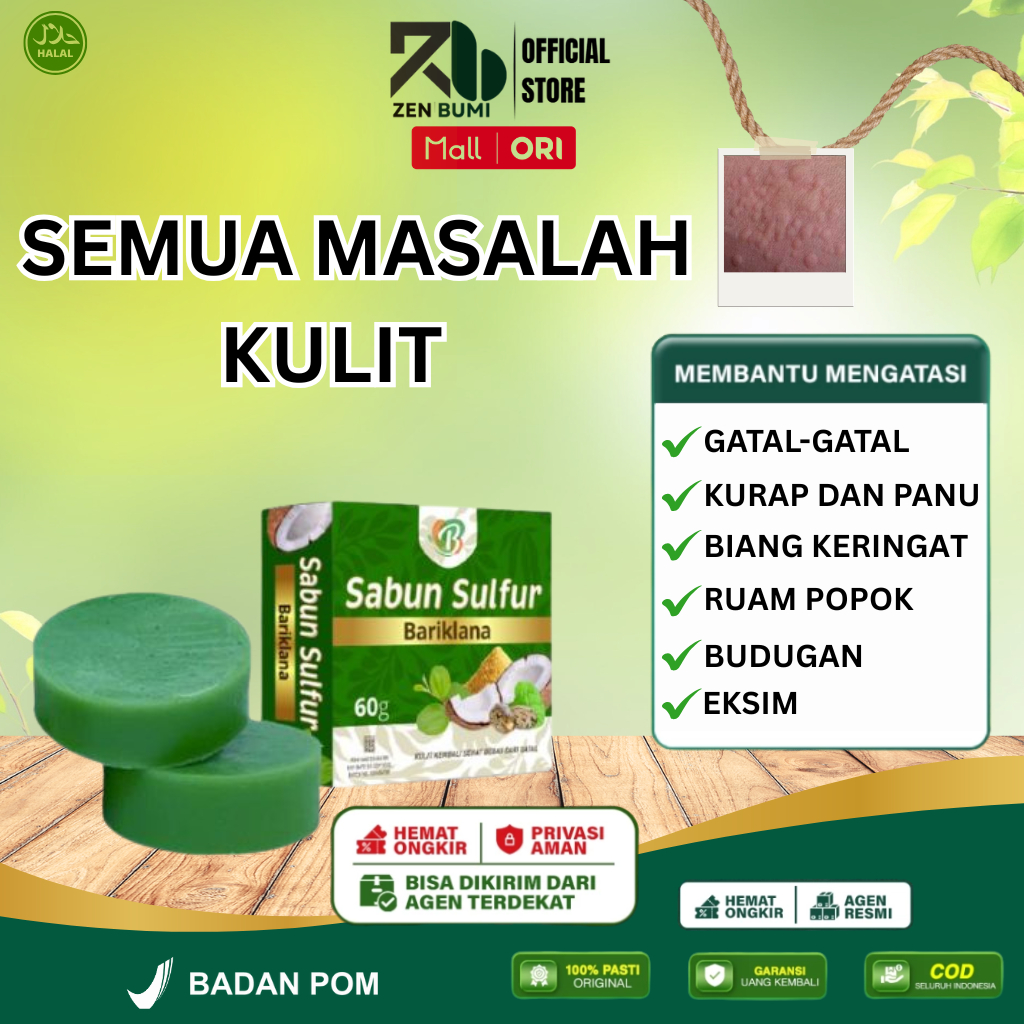 Sabun Sulfur - Sabun Gatal Paling Ampuh Anti Jamur, Gatal-gatal Seluruh Badan, Sabun Gatal Kulit, Sa