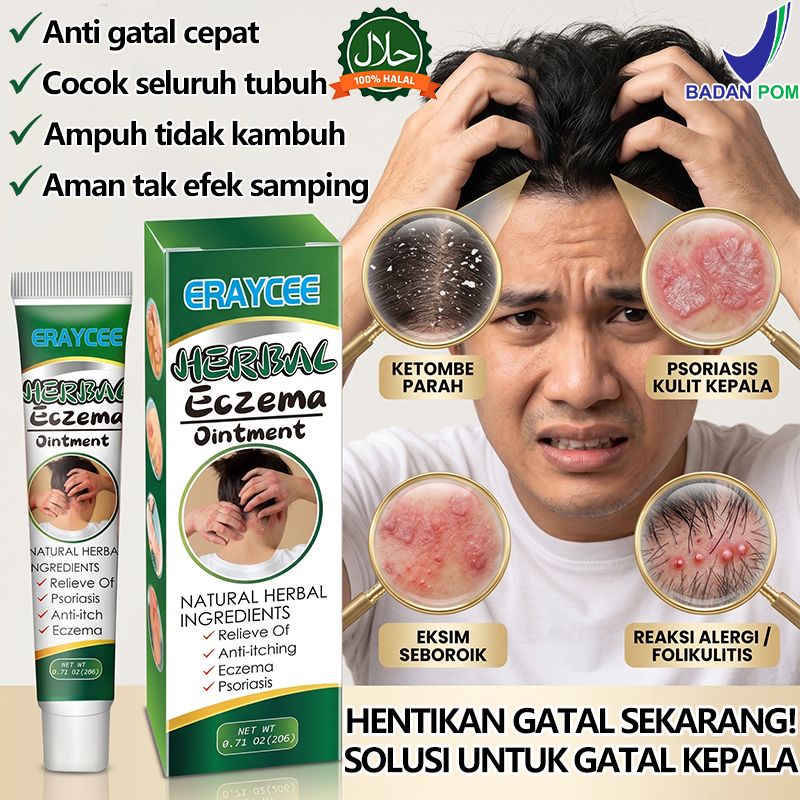 Salep gatal kepala paling ampuh Anti gatal cepat untuk Anak dan Dewasa 20g Obat Gatal Kepala, Eksim,