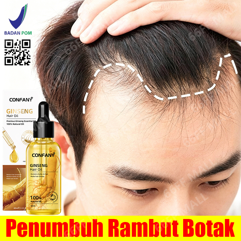 BPOM ginseng penumbuh rambut 60ml penumbuh rambut cepat dan tebal hair serum rambut rontok penumbuh 