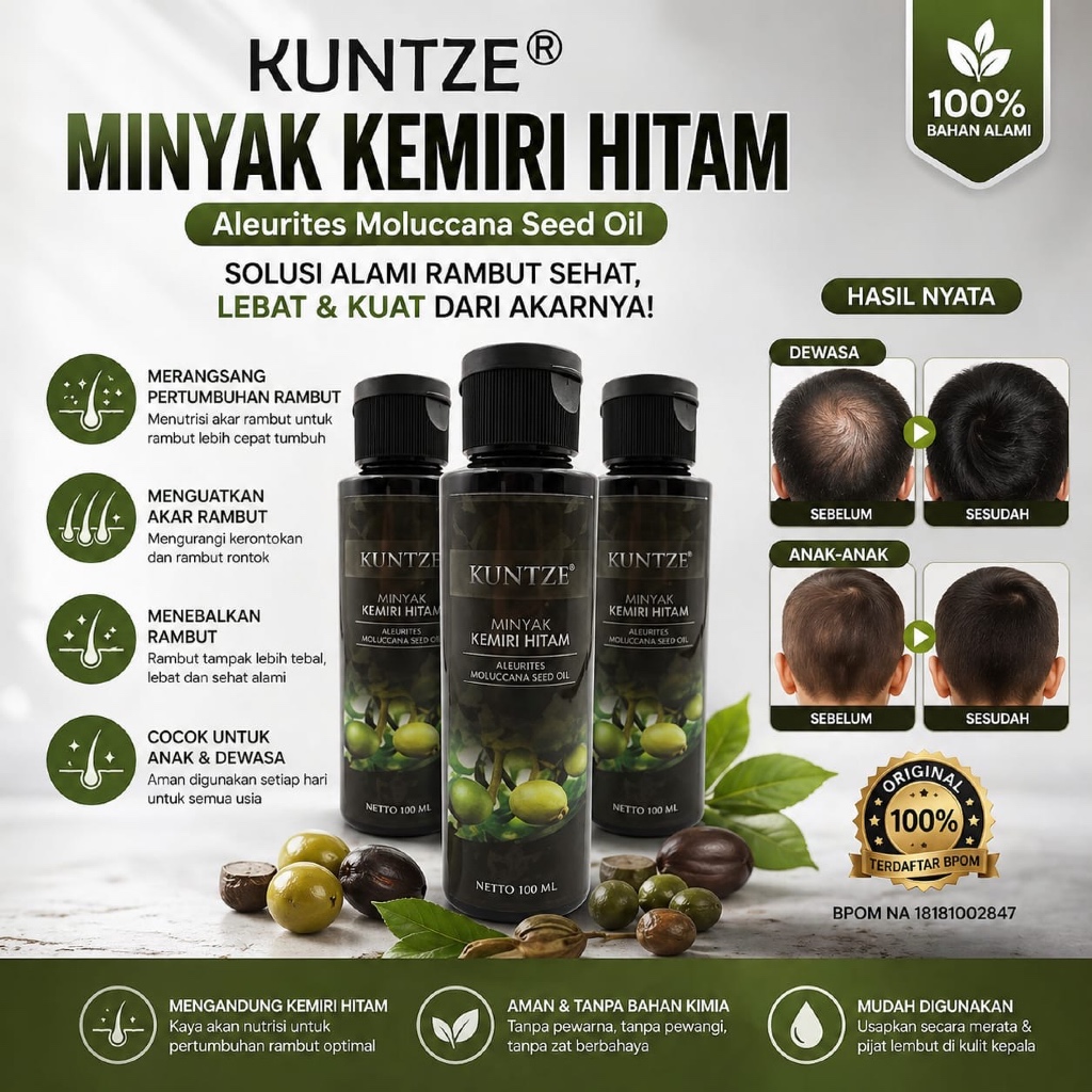 KUNTZE MINYAK KEMIRI HITAM 100ML - MINYAK KEMIRI PENUMBUH RAMBUT MINYAK KEMIRI ASLI 100% ORIGINAL KU