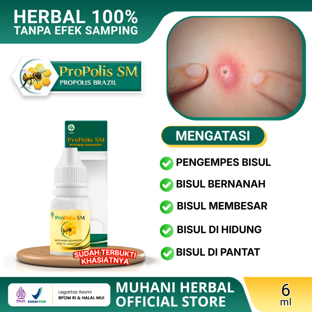 Obat Pengempes Bisul Propolis SM, Atasi Bernanah, Membesar, Di Hidung, Radang Bisul, Herbal Benjolan