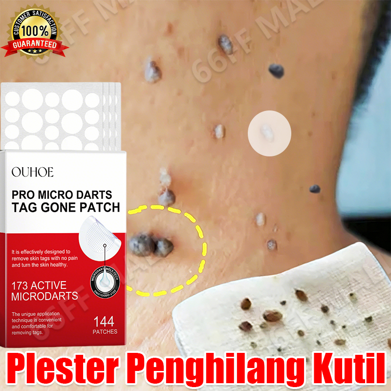penghilang kutil dan tahi lalat Penghilang Tahi Lalat Di Wajah  kutil remover plester kutil skin tag