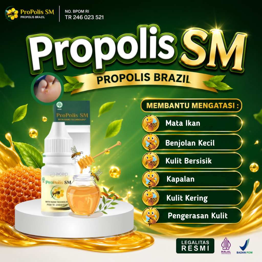 Obat Mata Ikan, Obat Mata Ikan Telapak Kaki, Obat Tetes Mata Ikan, Obat Penghilang Mata Ikan, Obat P