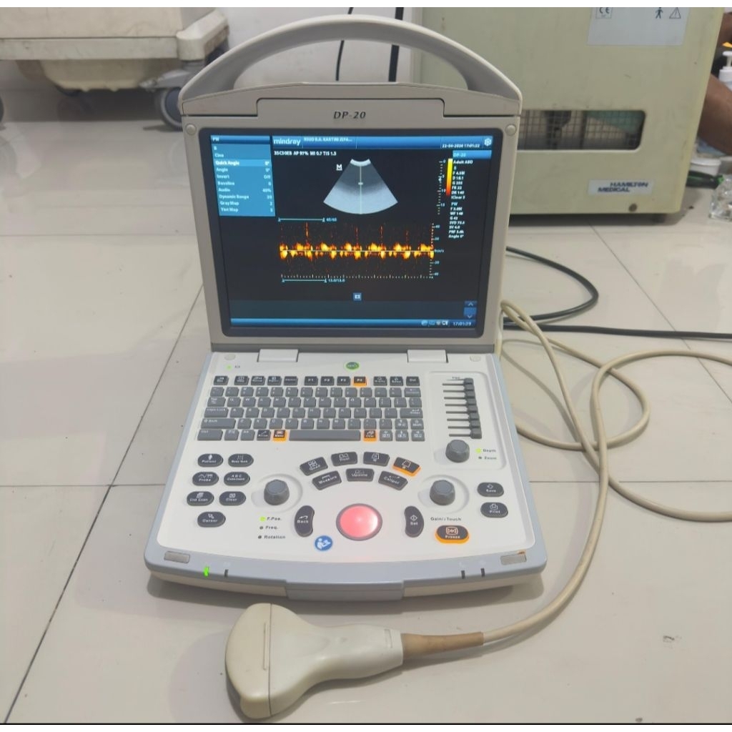 USG 2D MINDRAY SECOND COLOR DOPPLER