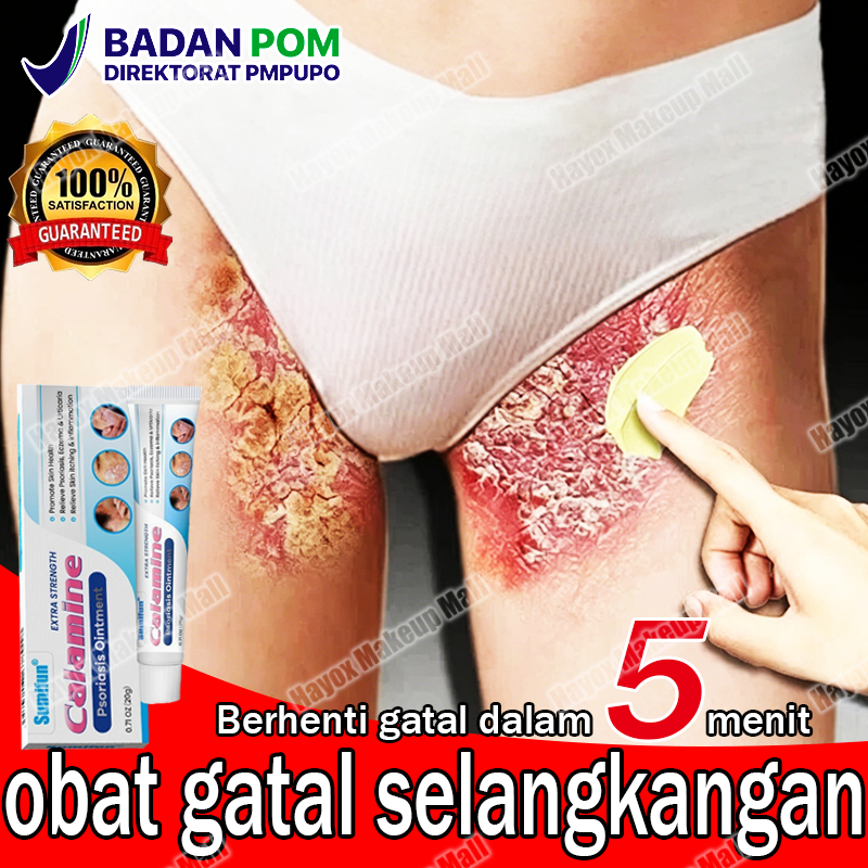 salep gatal salep eksim kering dan gatal salep jamur oba gatal paling ampuh psoriasis eksim dermatit