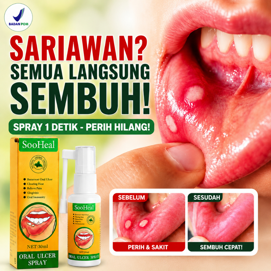 SooHeal Obat Semprot Sariawan 30ml - Ampuh Sembuh Cepat, Tidak Perih, Aman Tertelan, Sertifikasi BPO