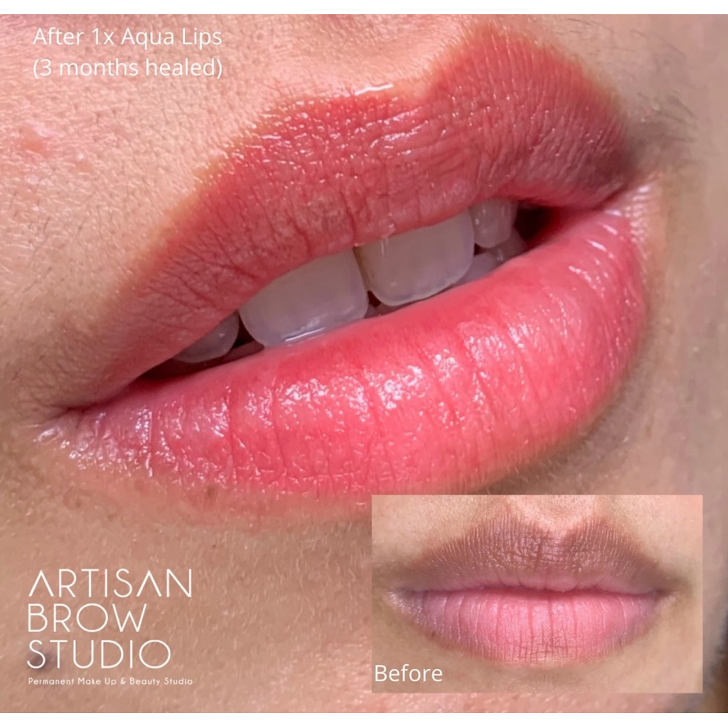 PELUNASAN | Aqua Lips (Favorite Treatment) by Lidya - Owner