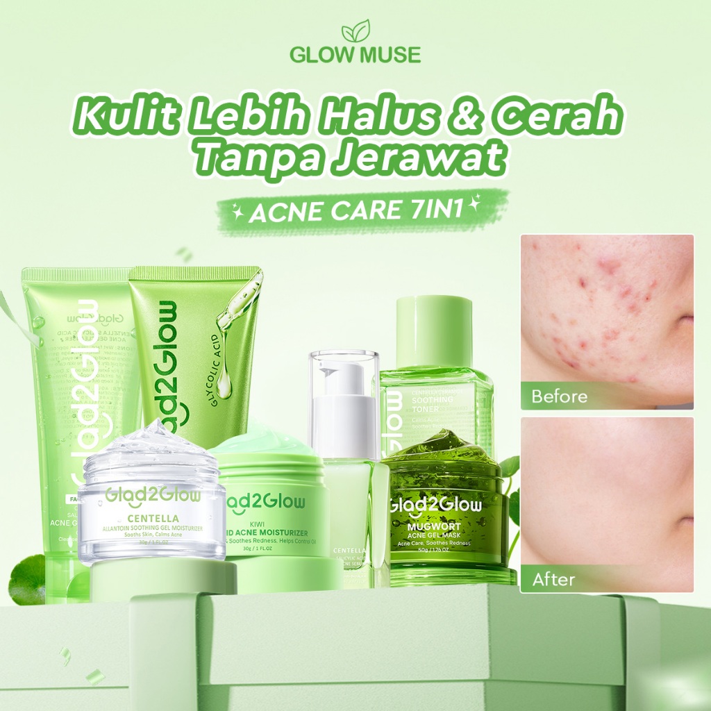 [100% ORI] Glad2Glow Acne Jerawat bundle all in 1 - 3/4/5/6 PCS Skincare Paket-Soothing toner+Centel