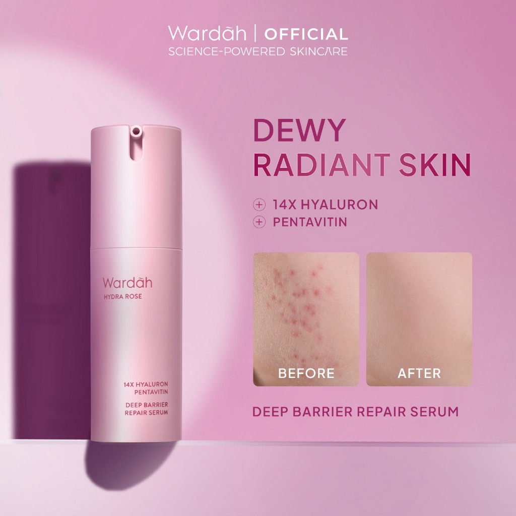 WARDAH Hydra Rose 14X Hyaluronic Pentavitin Deep Barrier Repair Serum 30 ml - Serum dengan Allantoin