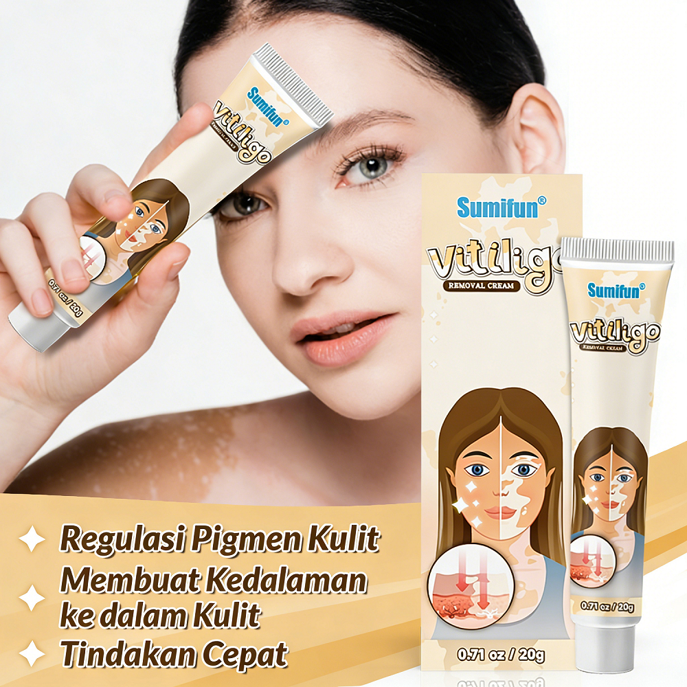 100% SALEP VILITIGO BERCAK PUTIH/KULIT BELANG / PANU / SALEP HIPOPIGMENTASI