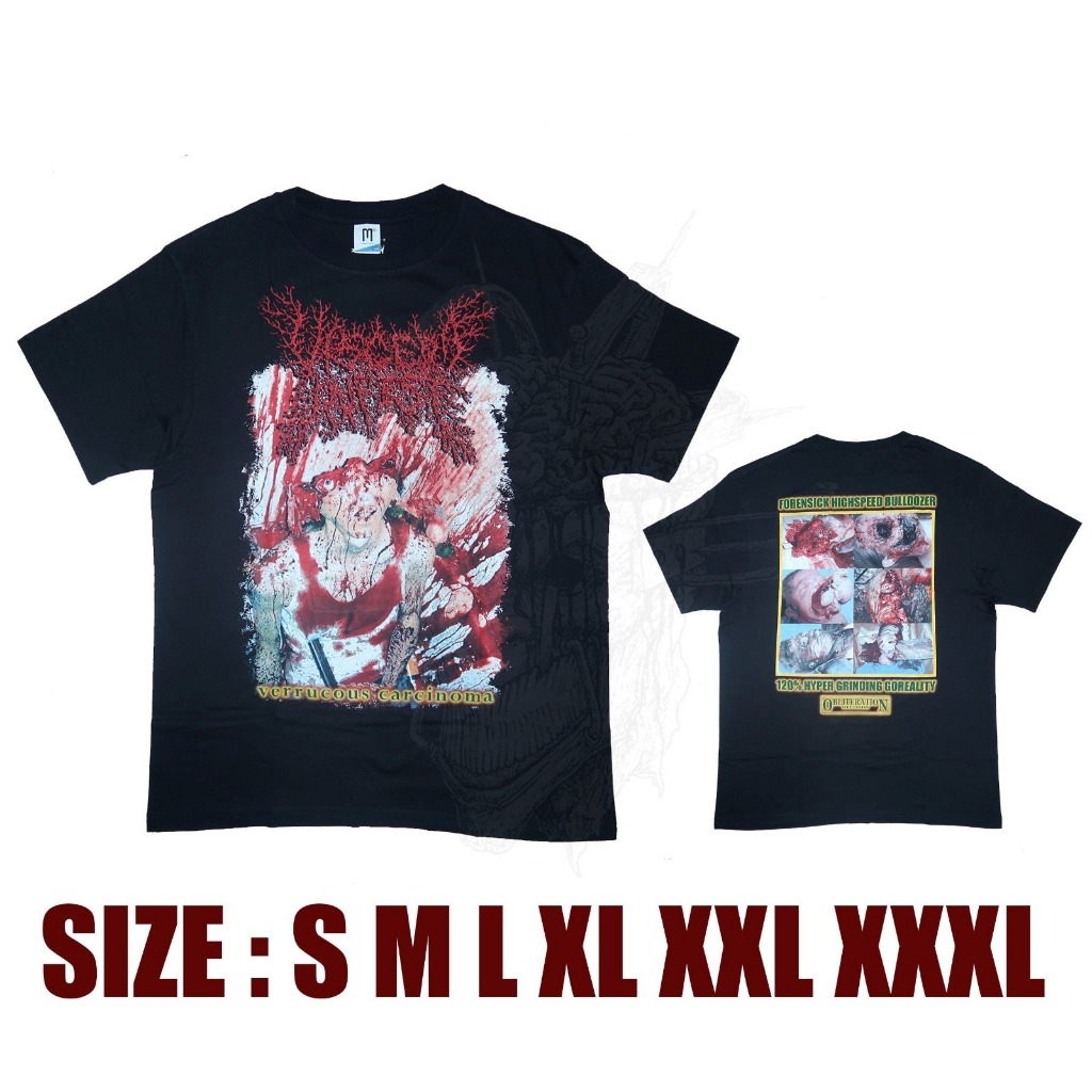 TSHIRT - VISCERA INFEST - VERRUCOUS CARCINOMA