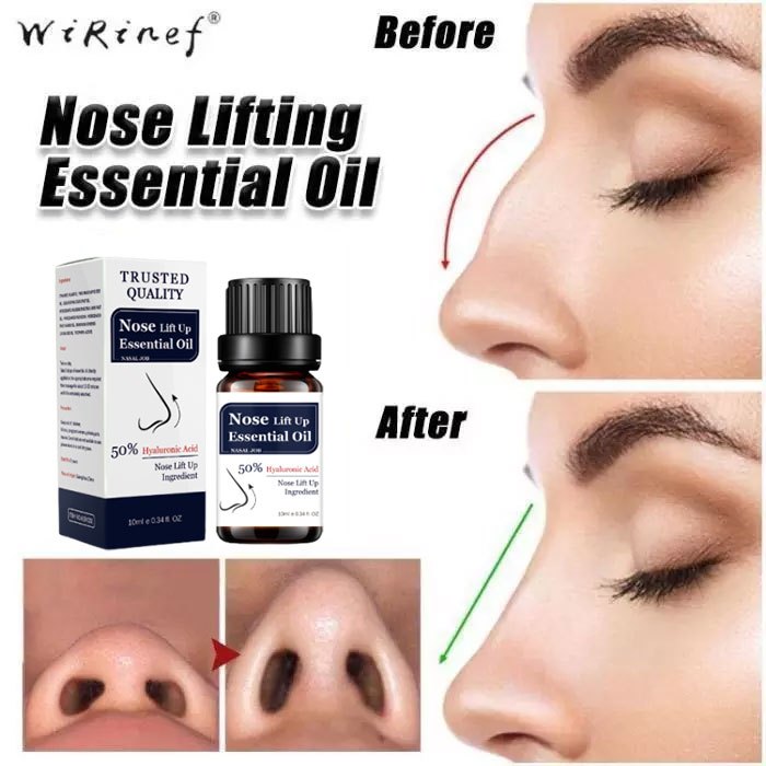 2 Weeks Result*Serum Pemancung Hidung Permanen Original Asli/ Minyak Pijat Esensial Pemancung Hidung