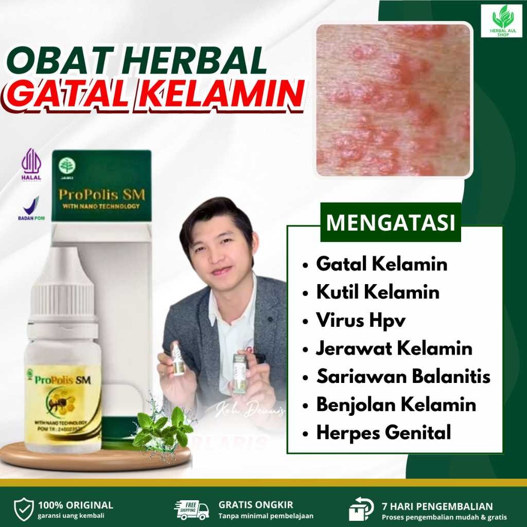 Propolis SM Obat Oles Gatal Kelamin, Kutil Kelamin, Virus Hpv, Jerawat Kelamin, Sariawan Balanitis, 