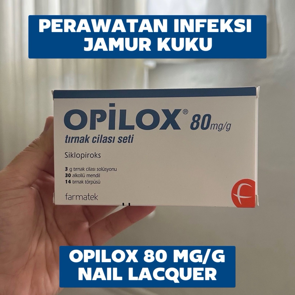 Opilox Perawatan Infeksi Jamur Kuku Alternatif Nibulen
