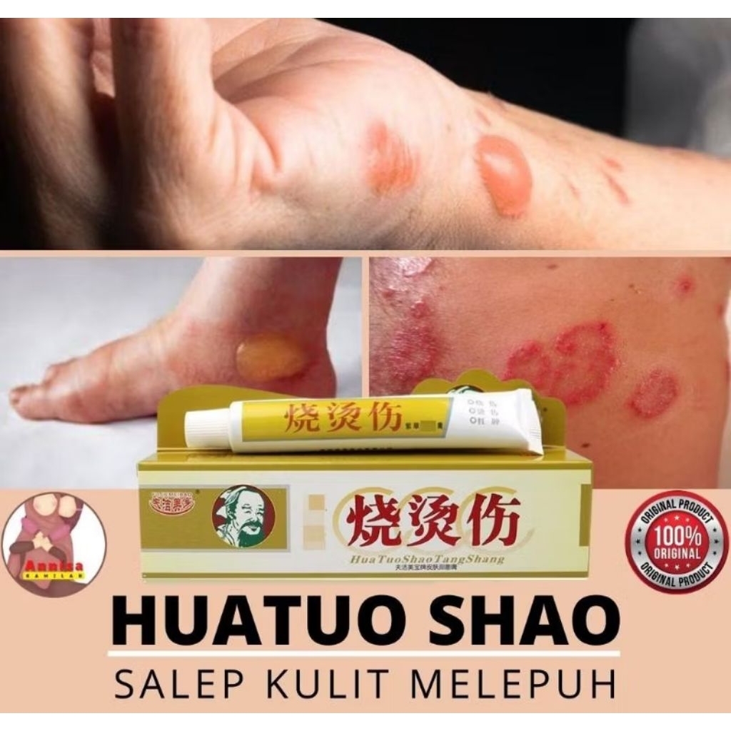 Salep Luka Bakar Hua Tuo Herbal 25g