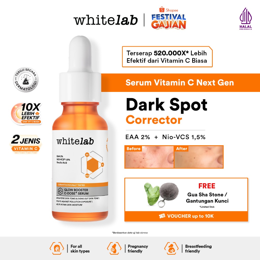 Whitelab Serum Vitamin C Glow Booster - Antioksidan Tinggi untuk Kulit Cerah dan Glowing C-Dose+ den
