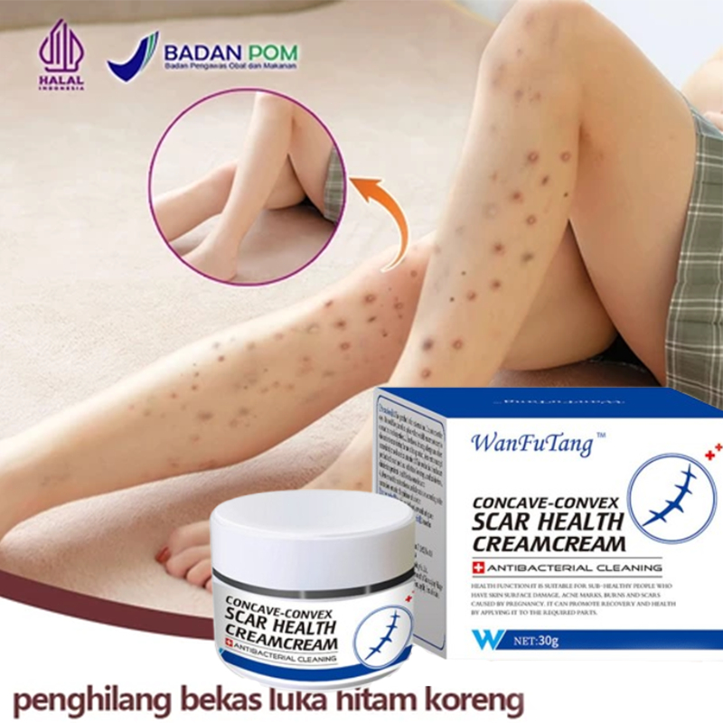 Salep Bekas Luka 30g | Penghilang Bekas Luka, Jahitan & Stretch Mark untuk Wajah & Badan