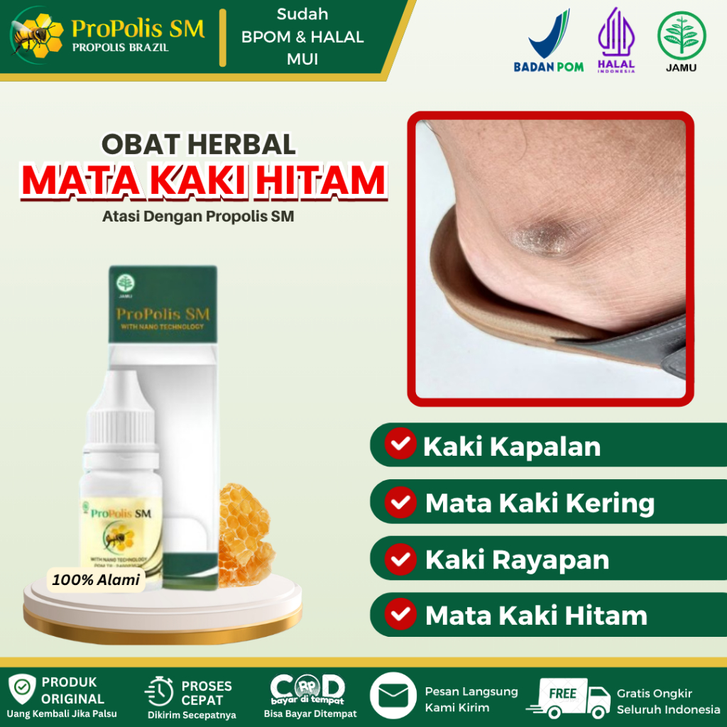 Obat Mata Kaki Hitam, Pemutih Mata Kaki Hitam, Kapalan, Mata Kaki Kasar, Sakit Mata Kaki Karena Gese