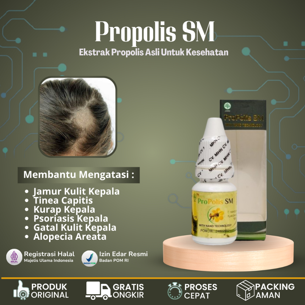 Obat Jamur Kulit Kepala, Obat Tinea Capitis, Obat Dermatitis Seboroik, Obat Penghilang Jamur di Kepa