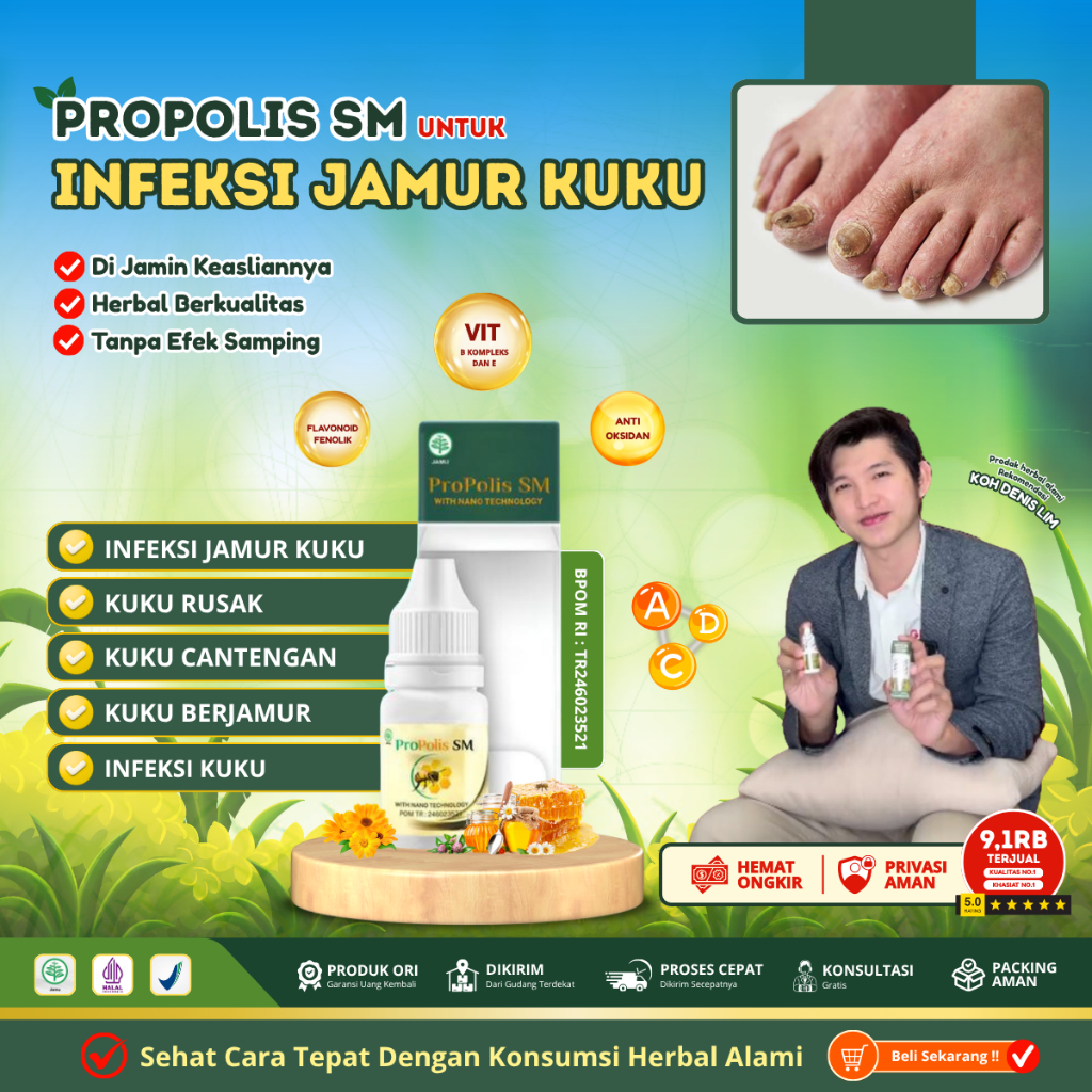 Obat Kuku Kaki Jamur Rusak Bau Busuk, Obat Psoriaritas Kuku, Obat Kuku Rusak , Obat Kuku Busuk