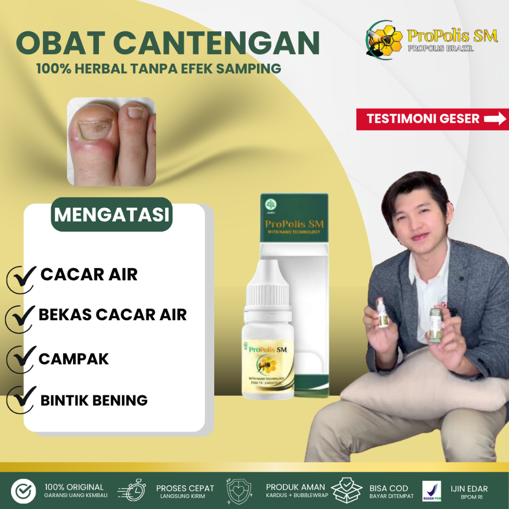 PROPOLIS SM, Obat Herbal Cantengan, Obat Cantengan, Obat Kuku Cantengan, Obat Cantengan Jempol Kaki,