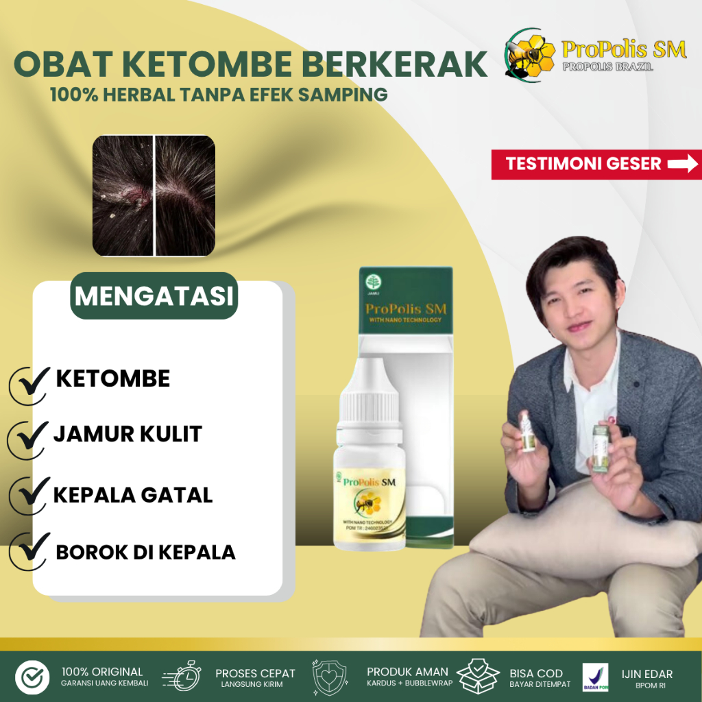 Obat Tetes Ketombe Parah, Obat Kulit Kepala Berkerak, Obat Ketombe Berkerak Obat Penghilang Jamur Ku