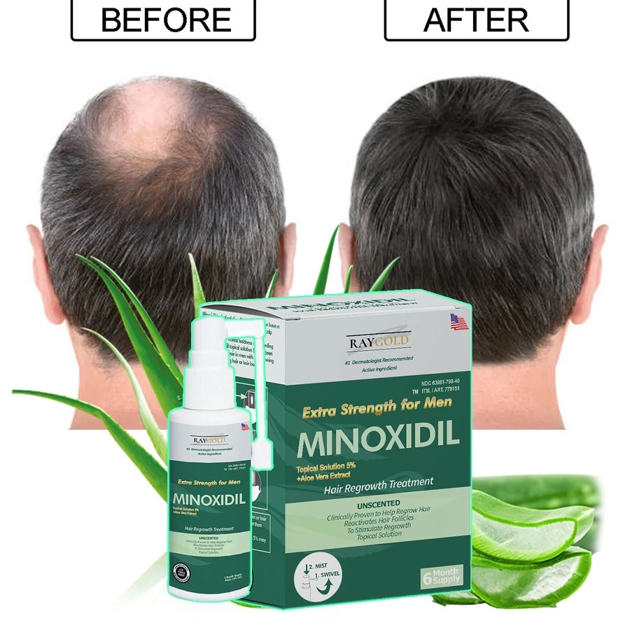 MINOXIDIL 5% penumbuh rambut & brewok with Aloe Vera for MEN made in USA - RAYGOLD - MINOX MINOKSIDI