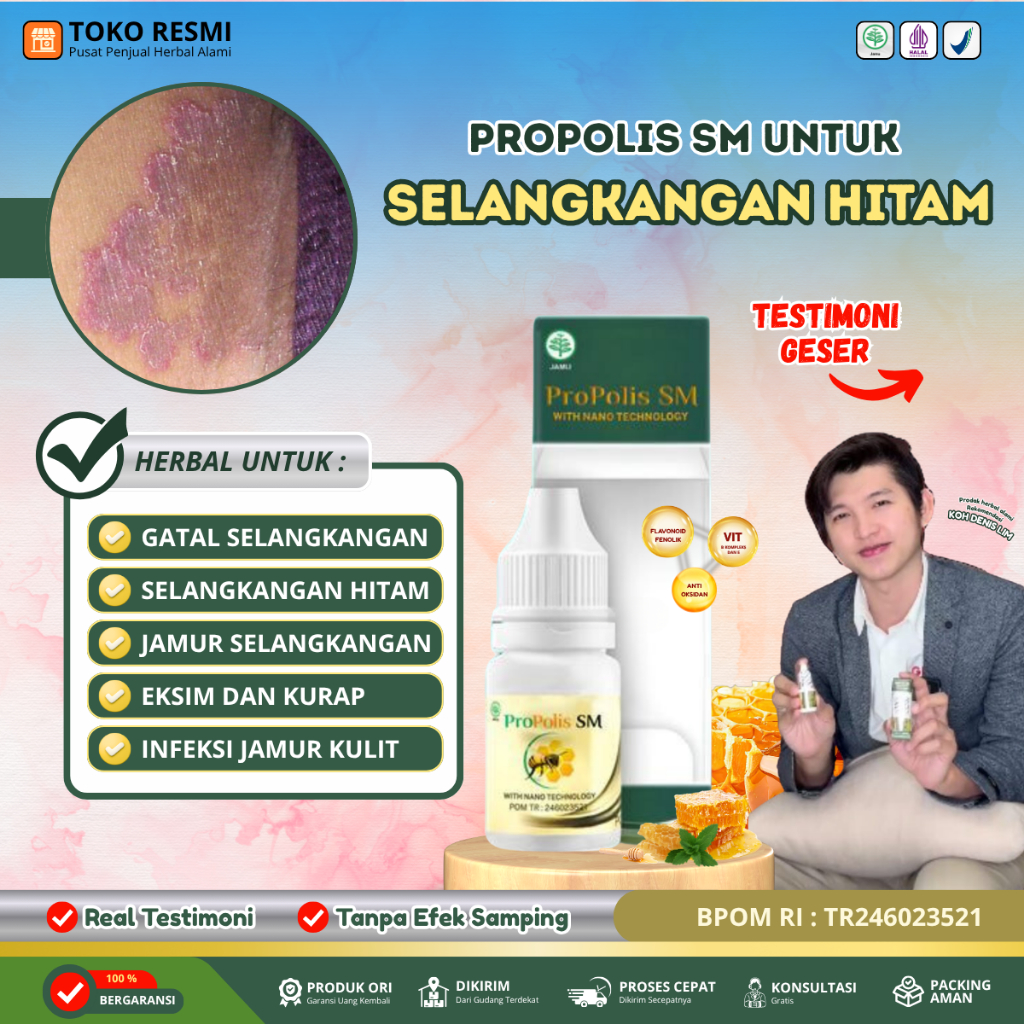 Obat Selangkangan Hitam Babak Gatal Berair Gatal Bernanah Gatal Psoriasis Eksim Jamur Kurap Alergi K