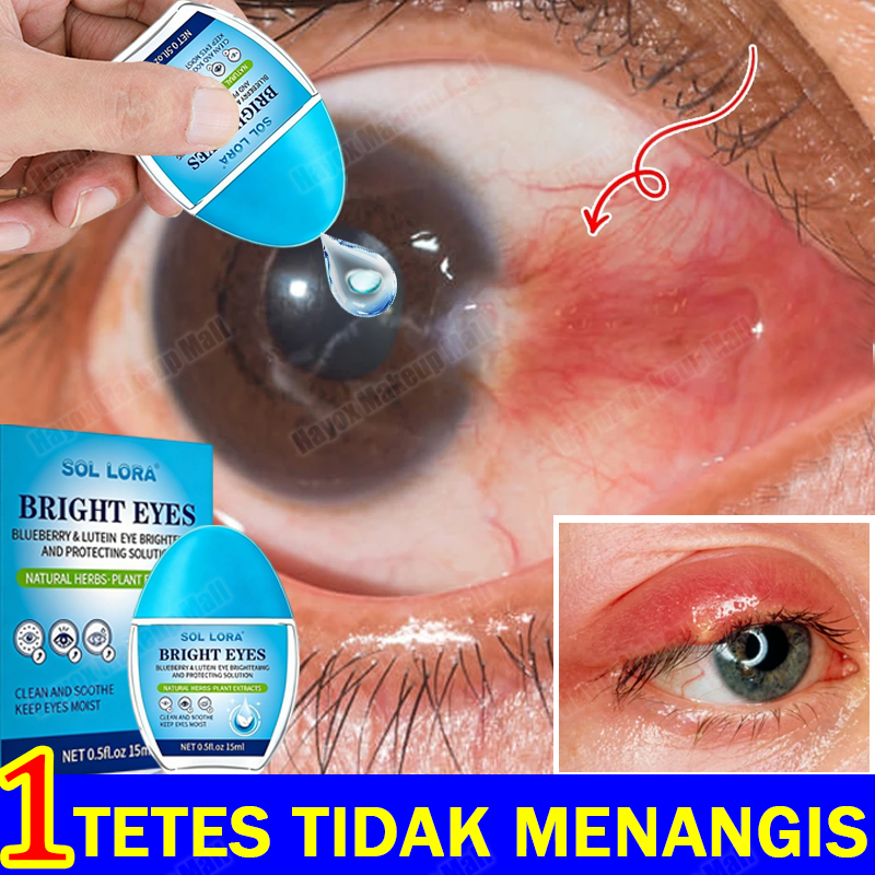 tetes mata 15ml obattetes mata ampuh tetes mata kering obat mata katarak obat tetes mata merah dan g