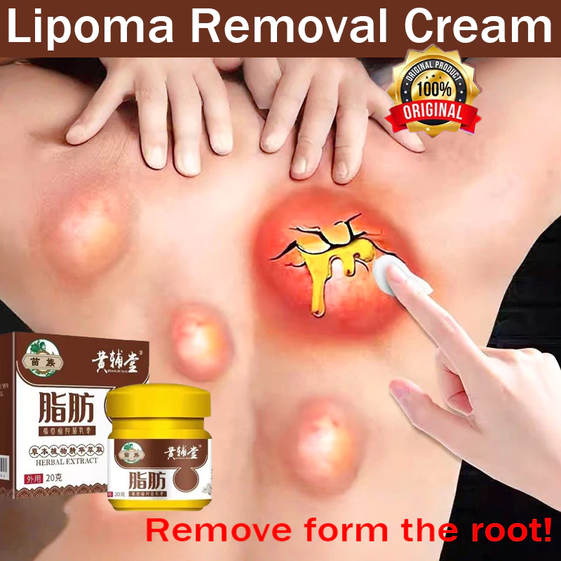 Lipoma cream original Obat benjolan lipoma Salep lipoma Paling ampuh Herbal Obat benjolan payudara M