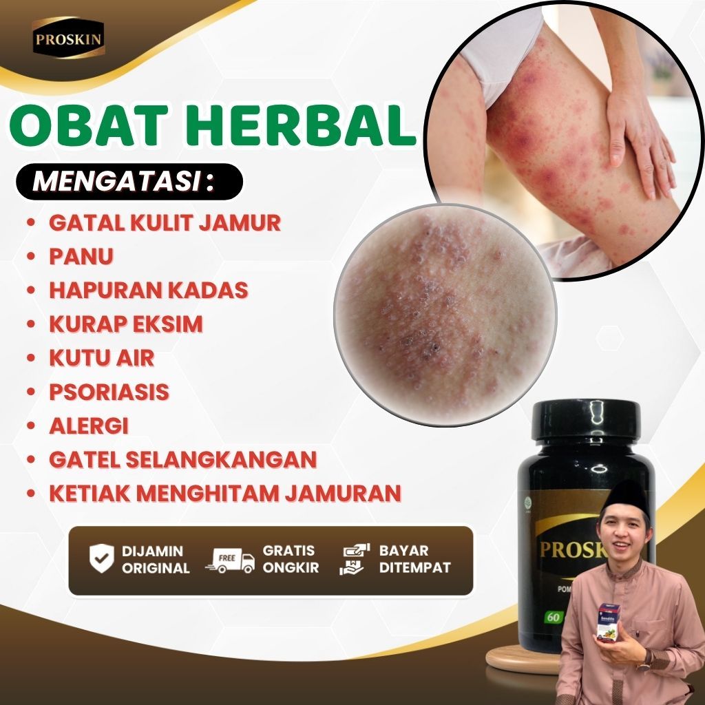 PROSKIN Kapsul Binahong Obat Gatal Kulit Jamur Panu Hapuran Kadas Kurap Eksim Kutu Air Psoriasis Ale