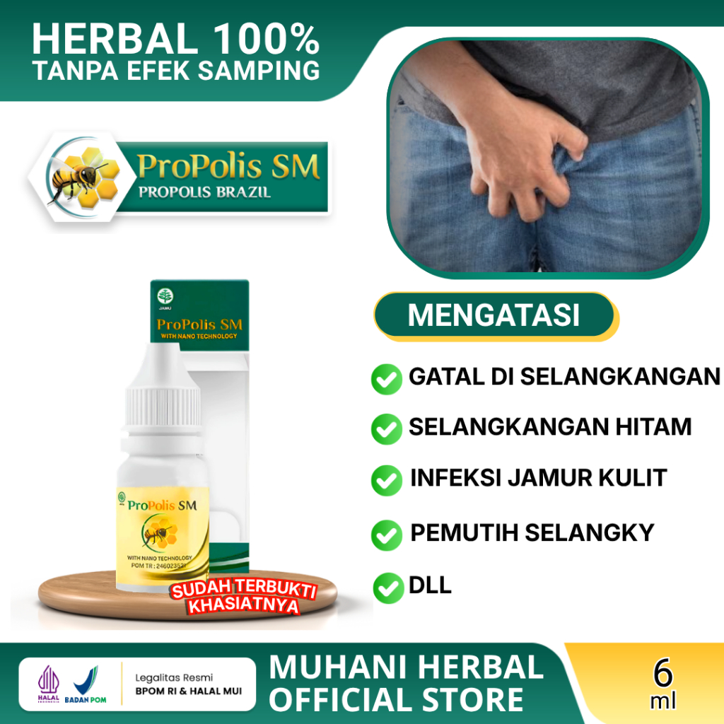 Obat Selangkangan Gatal Hitam Selangkangan Berjamur Herbal Oles Selangkangan Pria & Wanita Propolis 