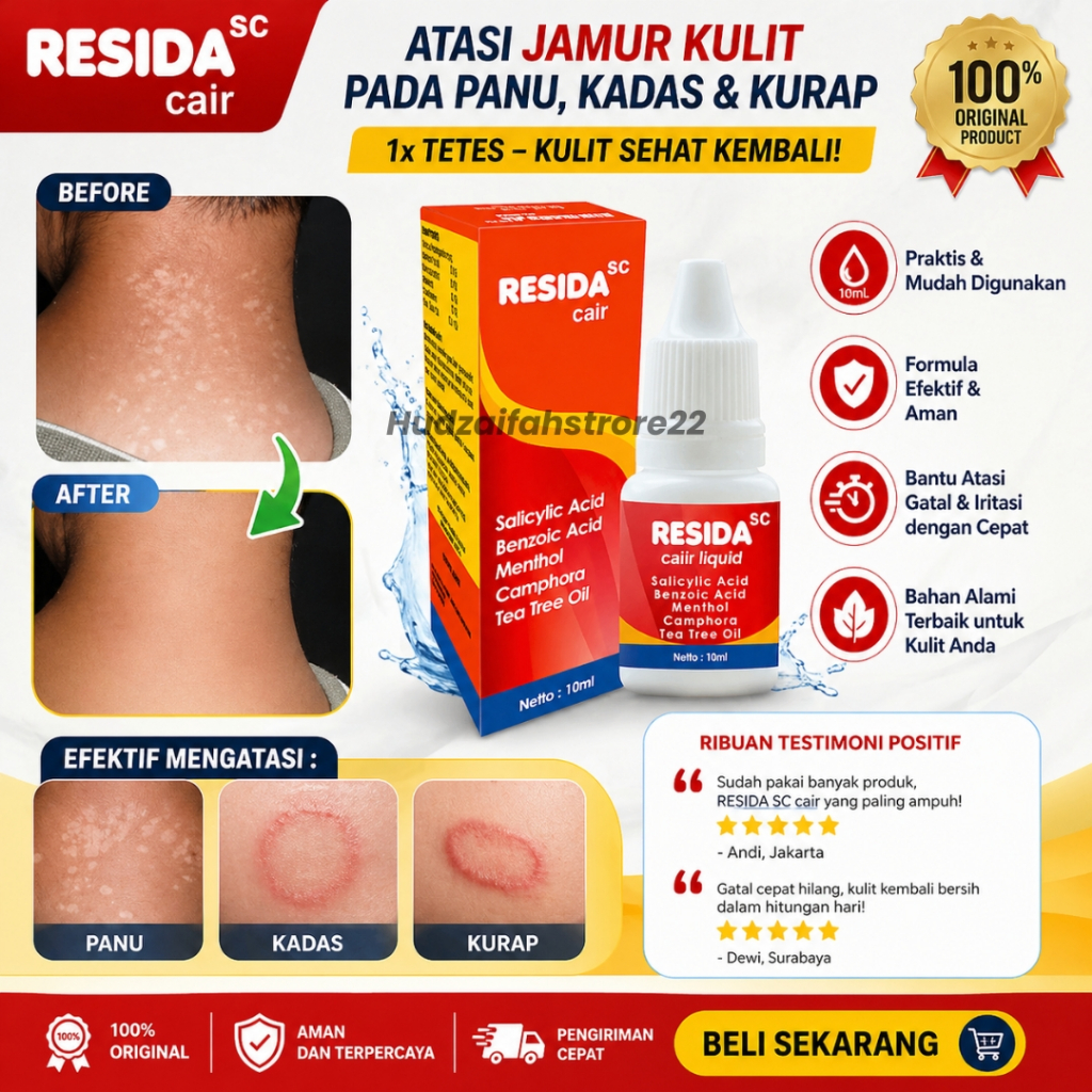 Resida Obat Panu Gatal Kulit Paling Ampuh 100% dan Cepat Kadas Kurap Kutu Air Selangkangan Eksim Jam