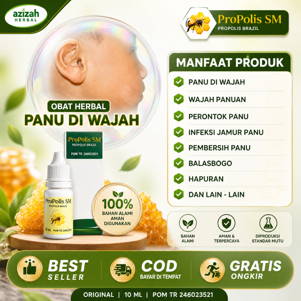 Propolis SM 100% Obat Penghilang Balas Bogo Paling Ampuh Namun Setiap Orang Hasilnya Berbeda Di Waja