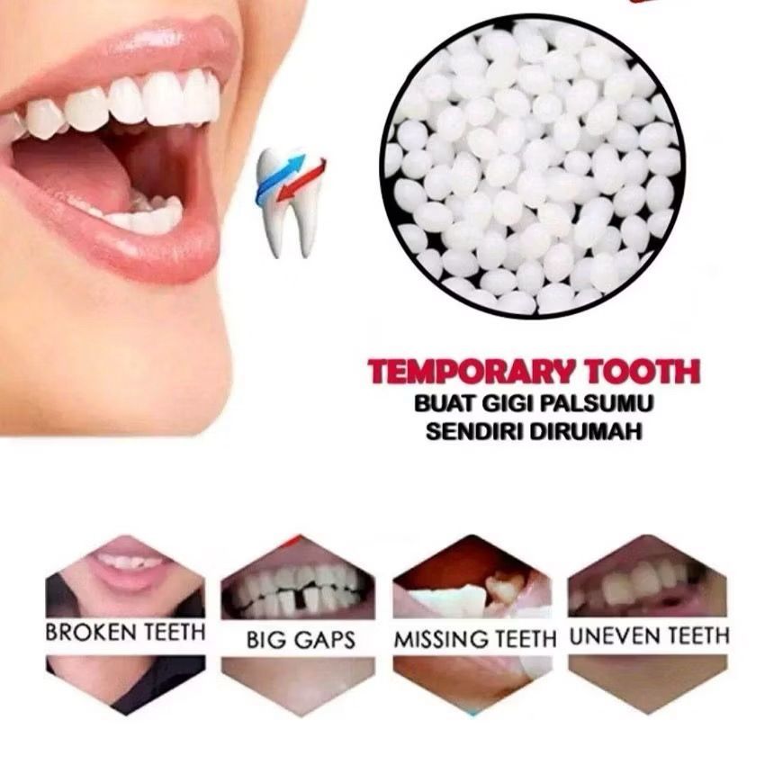 Tambal Gigi Sendiri di Rumah–Temptooth 100 Butir | Penambal Gigi Bolong, Gigi Copot, Gigi Sementara