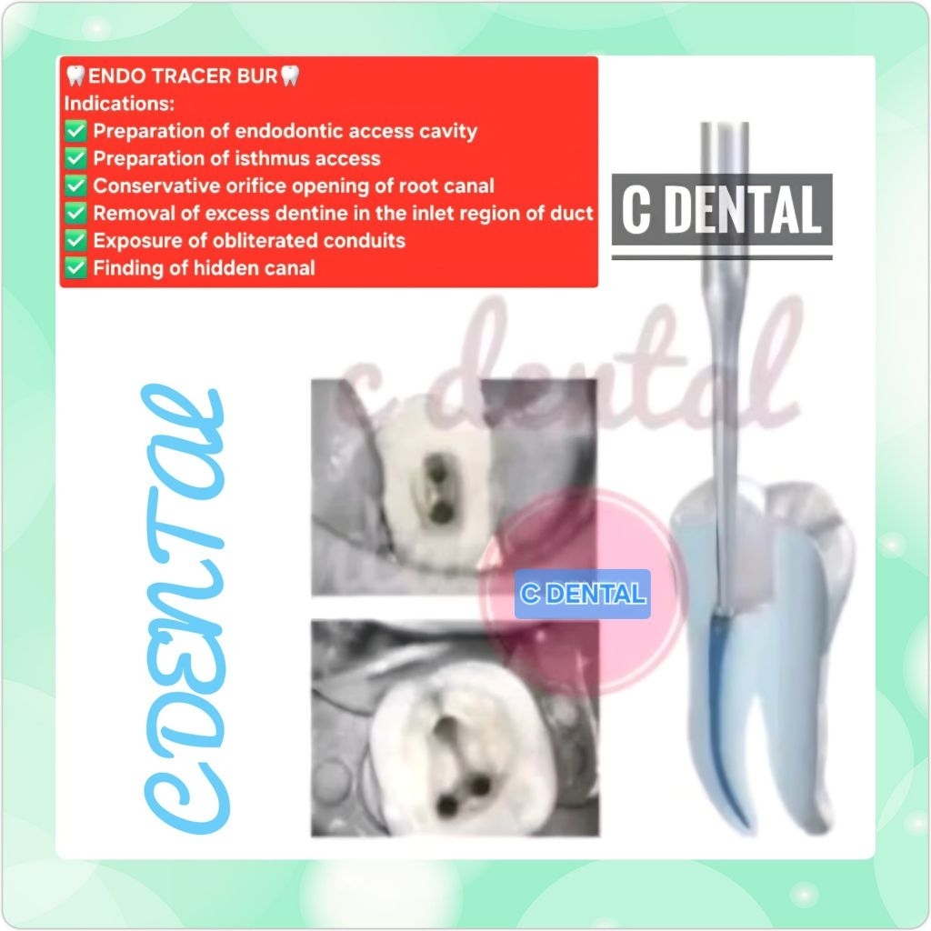 Dental Endo Orifice Tracer Bur Carbide Xtra Long Shank Opening Access Finding Hidden Canal