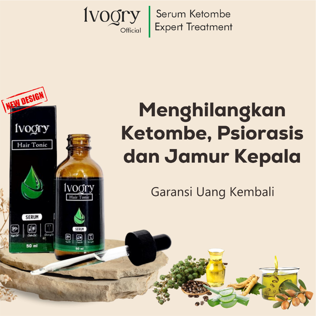 IVOGRY Obat Penghilang Ketombe Ampuh & Obat Ketombe Parah - Bantu Redakan Gatal & Kulit Kepala Berke
