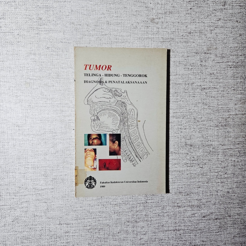 Buku Tumor Telinga Hidung Tenggorok Diagnosis & Penatalaksanaan: Fakultas Kedokteran Universitas Ind